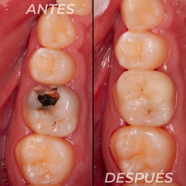 Antes-y-Despues-Dr-Gustavo-1