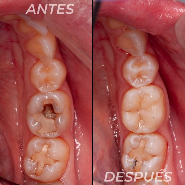 Antes-y-Despues-Dr-Gustavo-2