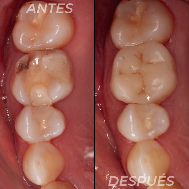 Antes-y-Despues-Dr-Gustavo-3