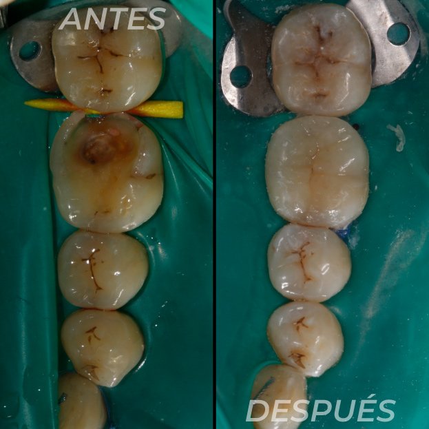 Antes-y-Despues-Dr-Gustavo-4