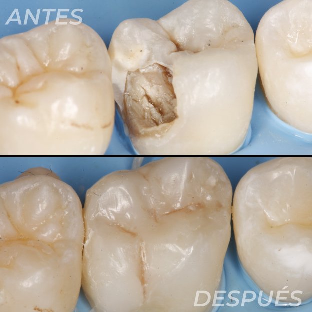 Antes-y-Despues-Dr-Gustavo-5