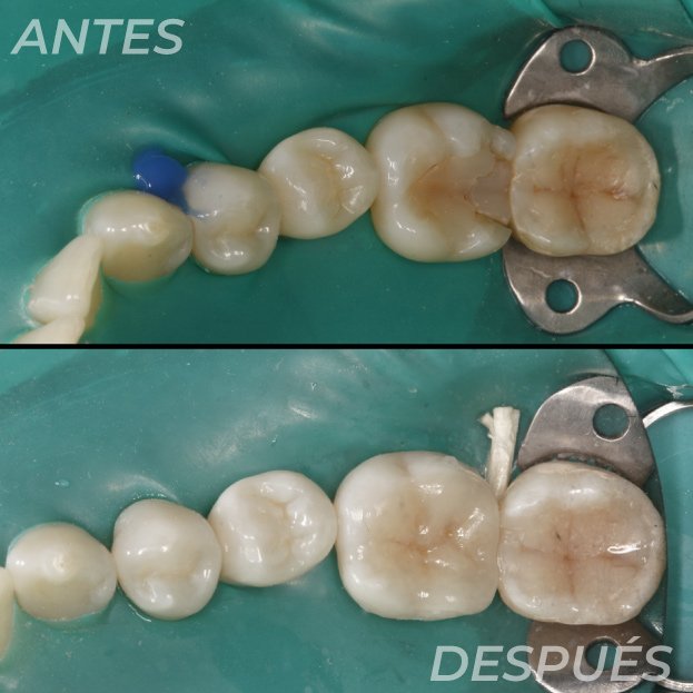 Antes-y-Despues-Dr-Gustavo-6